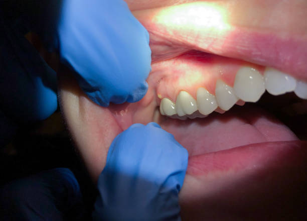 Best After-Hours Dental Trauma Care in Lake Landor, VA
