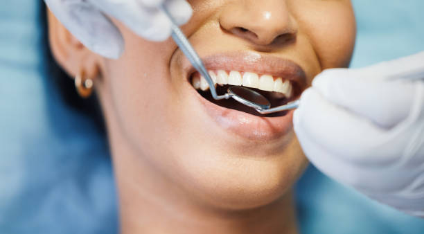 Best Emergency Dental Care for Broken or Chipped Teeth in Lake Landor, VA